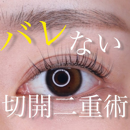 バレない切開二重術