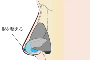 鼻中隔延長術の解説画像