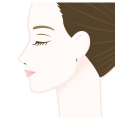 脂肪吸引の手術内容02