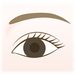 埋没法の手術内容04