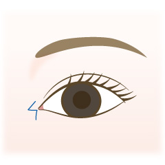 目頭切開の手術内容02