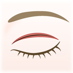 切開法の手術内容01