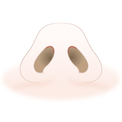 鼻尖形成術の手術内容01
