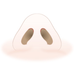 隆鼻術の手術内容01