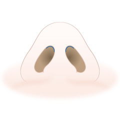 隆鼻術の手術内容04